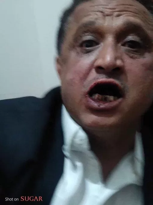 "سام" تدعو المجتمع الدولي لحماية الصحفيين في مناطق الحوثي
